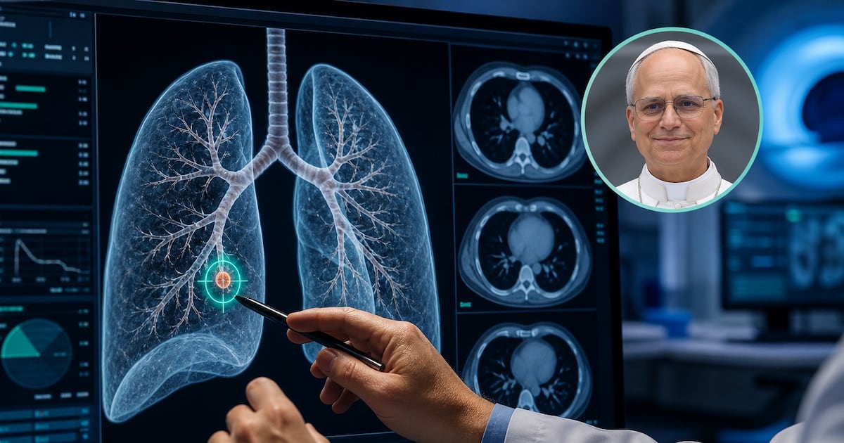 Nódulo pulmonar: por qué los médicos recomiendan operar incluso cuando mide apenas unos milímetros