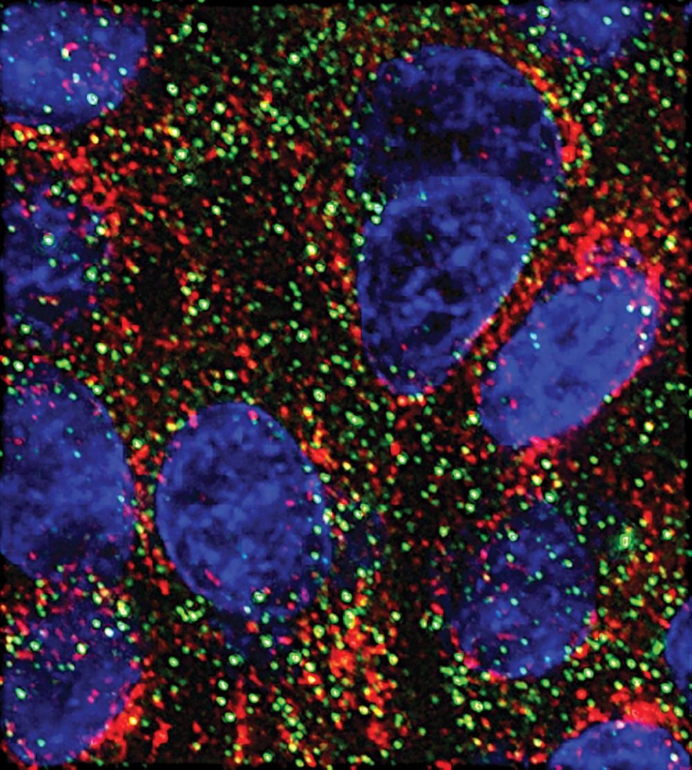 MicroARN Offers a New Path to Slowing Pancreatic Cancer Growth